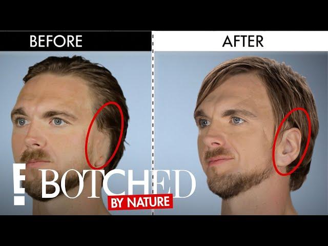 The Modern Day Van Gogh | Botched By Nature | E! Entertainment