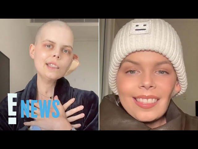 TikTok Star Bella Bradford Announces Her Own Death in Final Video After Cancer Battle | E! News