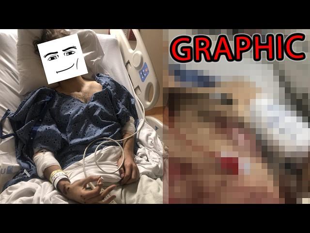 ruben sim almost died