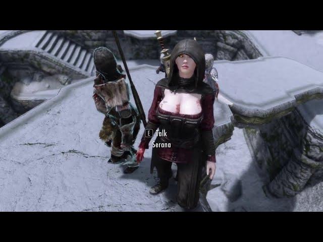 "Serana Say.........WHAT???"