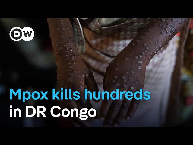 WHO warns mpox virus likely to spread | DW News