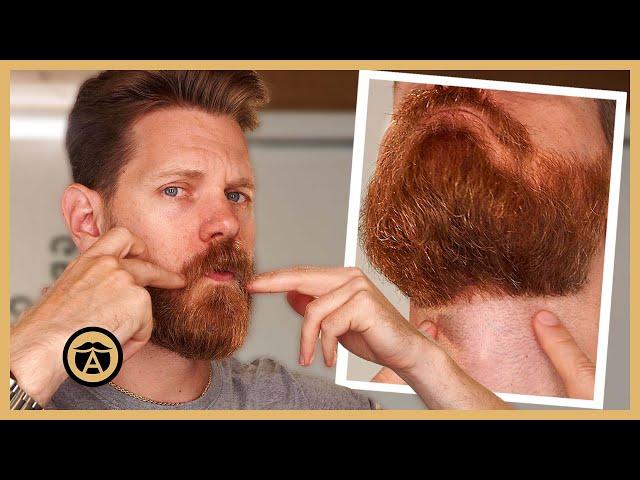 How To Grow An Incredible Beard