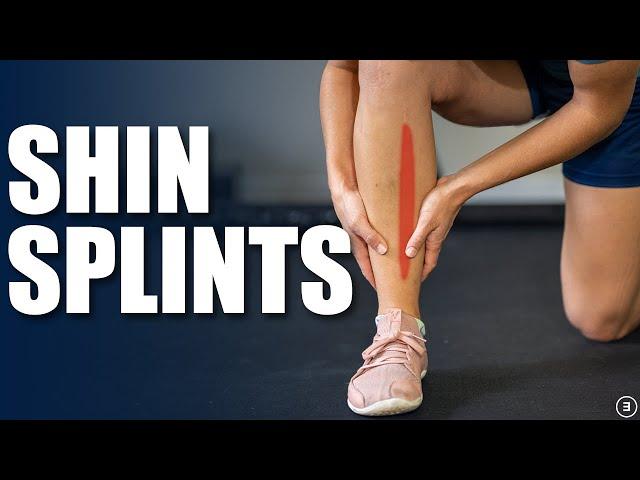 Shin Splints | Medial Tibial Stress Syndrome (Exercises, Rehab, Strengthening)