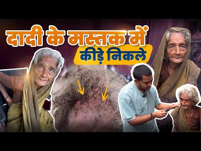 दादी के मस्तक में कीड़े निकले | Popatbhai Ahir