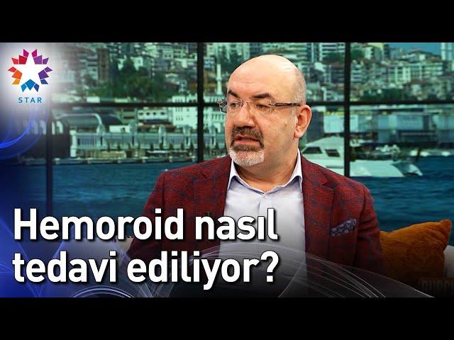 Hemoroid Nasıl Tedavi Ediliyor? - Burcu ile Hafta Sonu