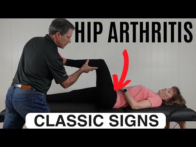 Classic Signs of Hip Arthritis