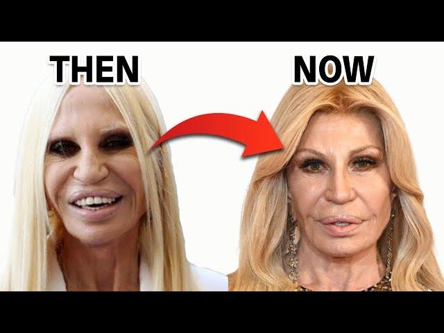 Donatella Versace's Stunning Comeback From Plastic Surgery Disaster