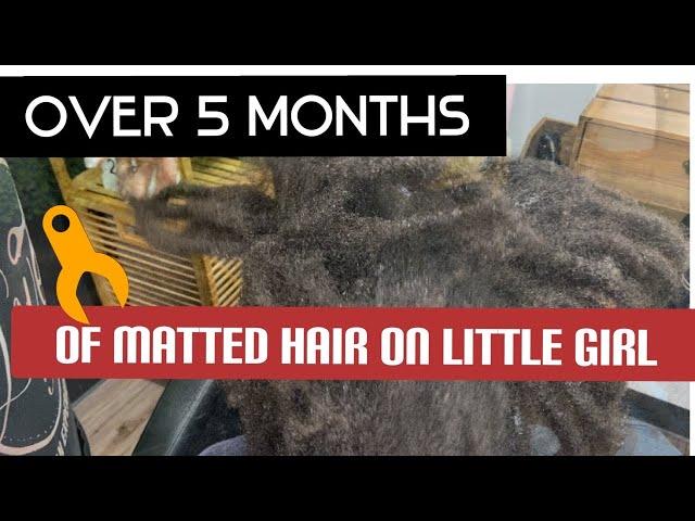 Detangling a child’s matted hair.