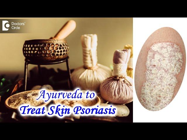 Ayurvedic Treatment for managing Skin Psoriasis | PSORIASIS - Dr. Chaithanya K S | Doctors' Circle