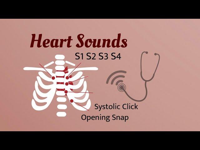 Heart Sounds (S1 ,S2 ,S3 ,S4 ) Systolic Click ,Opening Snap ..With audio of Heart Sounds