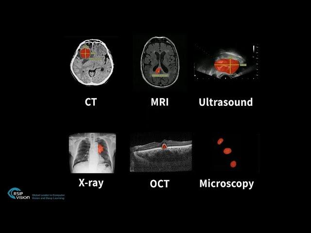 One-click segmentation in medical imaging - by RSIP Vision