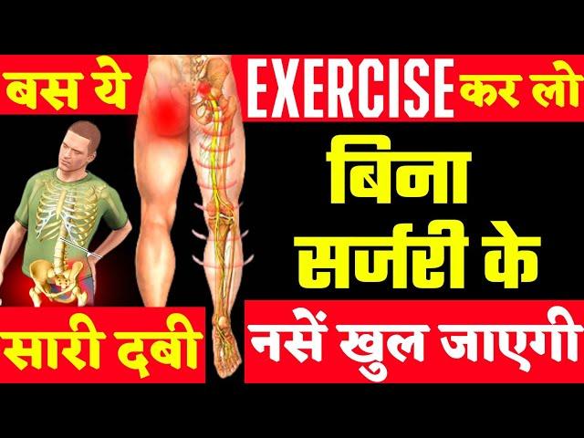 बिना ऑपरेशन कमर के दबी नस खोलें तुरंत |Sciatica Pain Relief Exercises