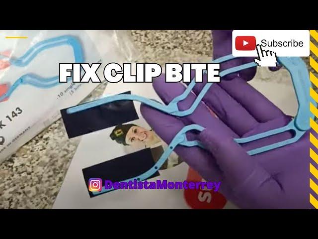 Fix Clip BITE  Frame  Oclusión Bilateral Simultaneamente