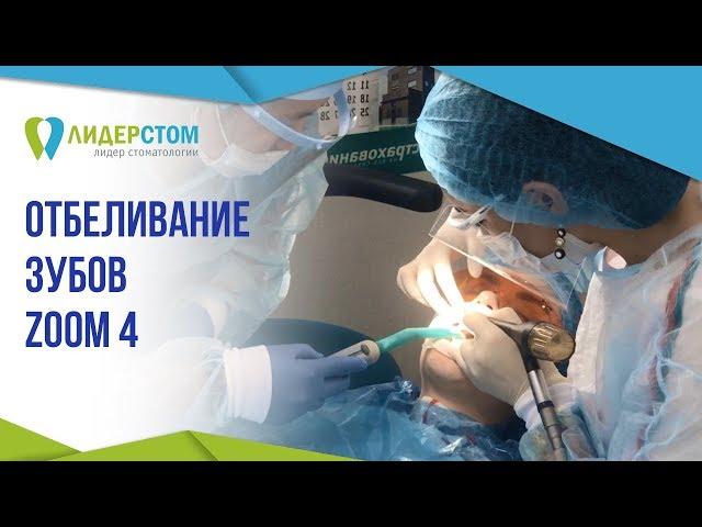 Отбеливание зубов ZOOM4  Противопоказания лазерного отбеливания зубов