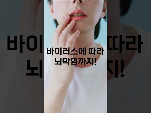요새 어린아이들이 자주 걸린다는 수족구병! 어떤 병일까?