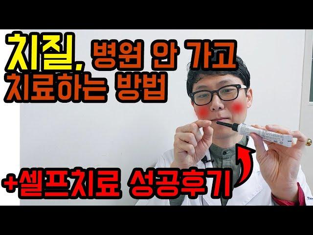 치질약 총 정리 + 정약사의 치질 셀프치료 후기 공유합니다.