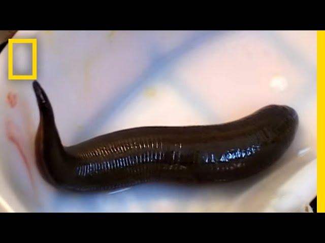 Leeches Cure | National Geographic