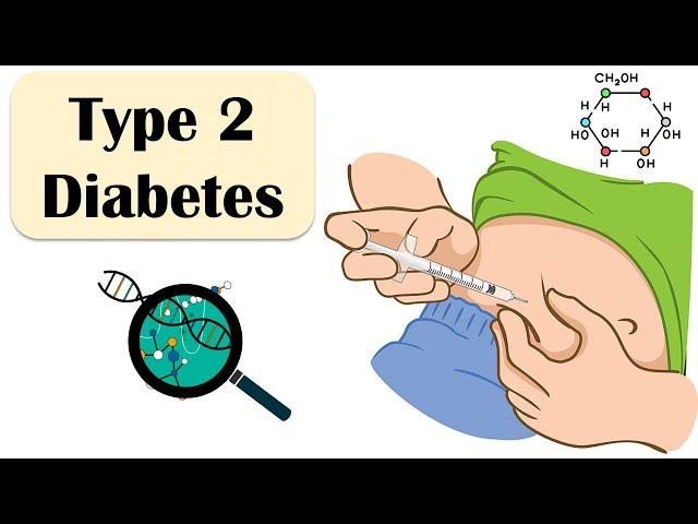 Type 2 Diabetes - Causes, Risk Factors, Signs & Symptoms, Treatment - Everything You Need To Know