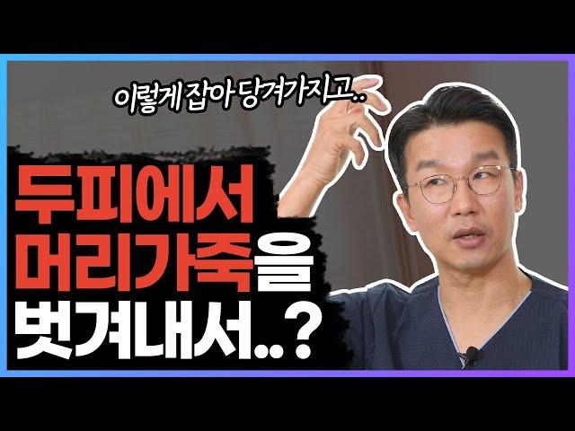 내시경으로 이마주름을 폈더니 눈까지 커짐!!