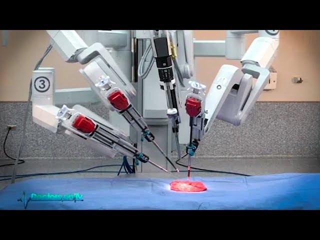 Actual demo of robotic surgery for prostate cancer