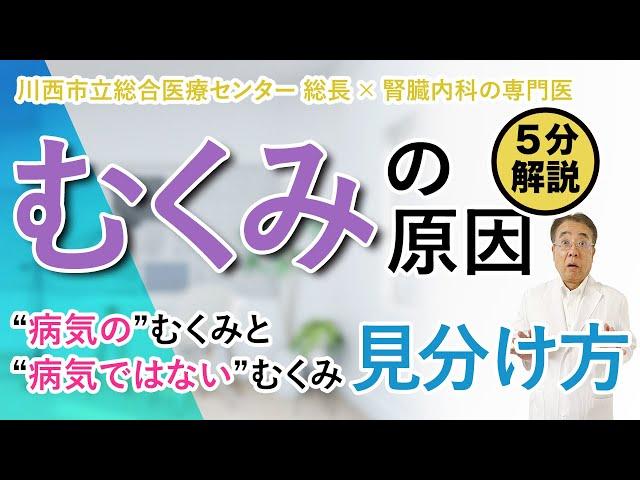 【むくみの原因】”病気”のむくみと”病気ではない”むくみの見分け方を教えます