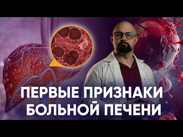 КАК ПОНЯТЬ, ЧТО ПЕЧЕНЬ УМИРАЕТ? АЛКОГОЛЬНЫЙ ЦИРРОЗ, ГЕПАТИТЫ, АСЦИТ. СИМПТОМЫ БОЛЕЗНЕЙ И ЛЕЧЕНИЕ.