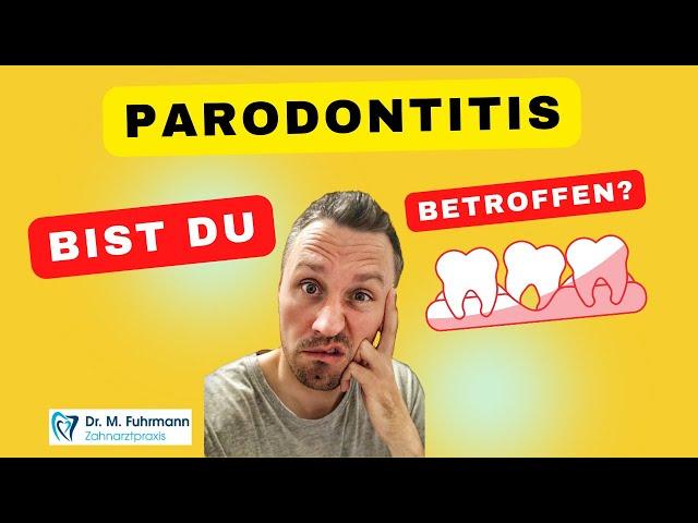 Hast du Parodontose ‍️ | Zahnarzt Dr. Maximilian Fuhrmann