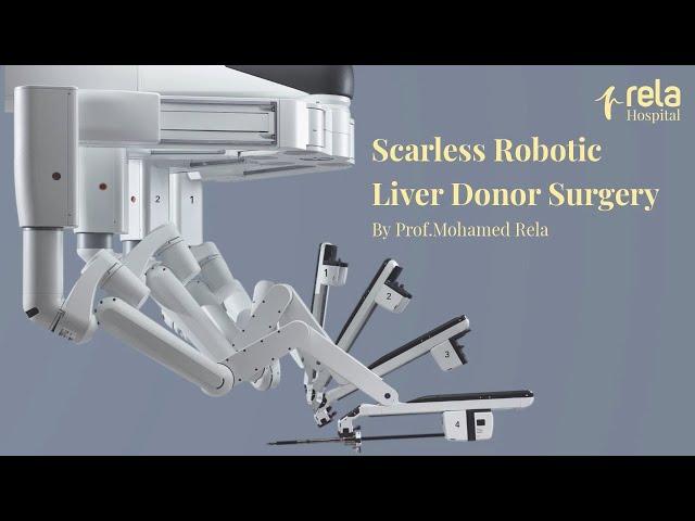 Watch Prof. Mohamed Rela performing a Scarless Robotic Liver Donor Surgery