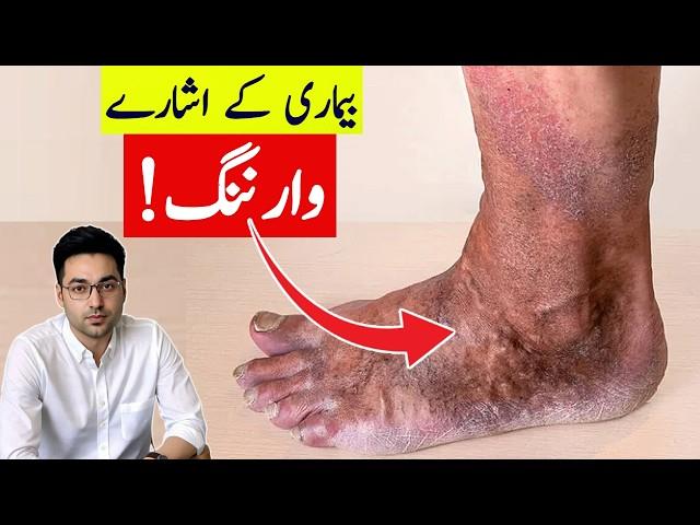 Dr. Zee:Use Your Feet As Warning Signs | डॉक्टर ज़ी