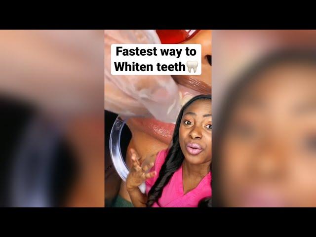 Fastest way to whiten your teeth. #whiteteeth #hygienist