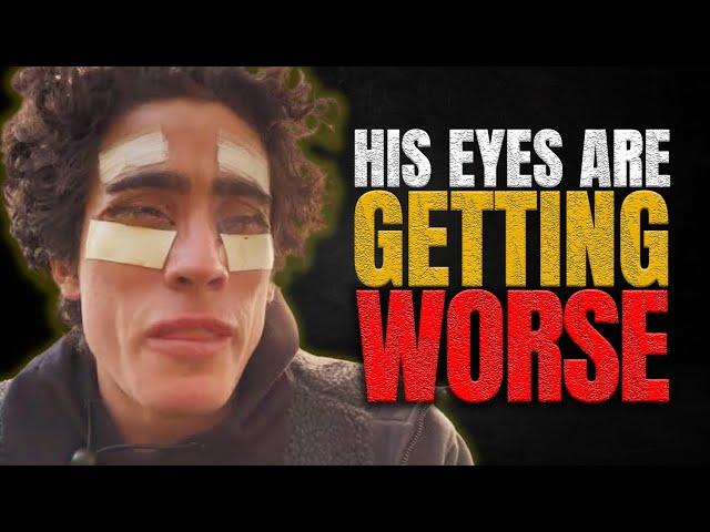 Cosmetic Surgery Fails: The Conspiracy behind Frank Tufano's Botched Eye Surgery