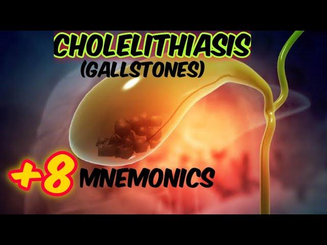Cholelithiasis | gall stones mnemonics|medical_mnemonics786