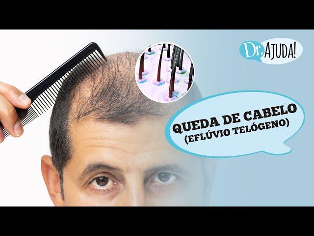 QUEDA DE CABELO (EFLÚVIO TELÓGENO): O QUE É, CAUSAS, DIAGNÓSTICO E TRATAMENTO