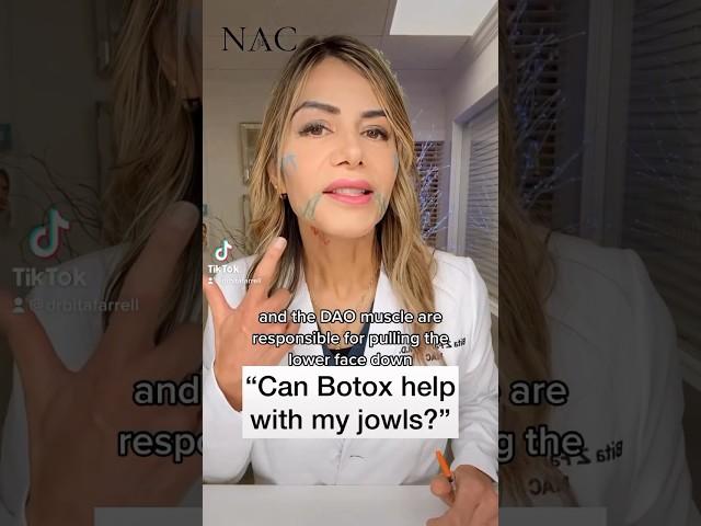 Can Botox help with my jowls?  #botox #jowls #antiaging