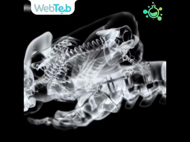 فيديو توضيحي لعملية الولادة   ويب طب