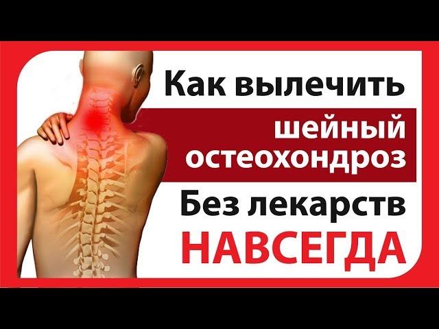 Шейный остеохондроз. Как лечить?