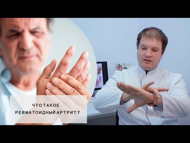 РЕВМАТОИДНЫЙ АРТРИТ l Что это такое? l Симптомы, Пути лечения