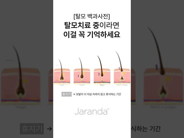 탈모치료 중이라면 이건 꼭 기억하세요!