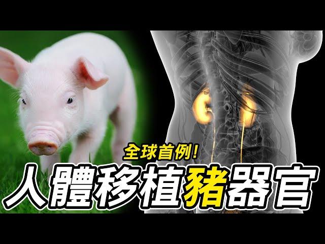 全球首例人體移植豬腎手術成功！如何解決器官排斥問題？