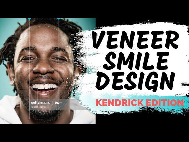 Digital Smile Design | How to Design Porcelain Veneers Digitally