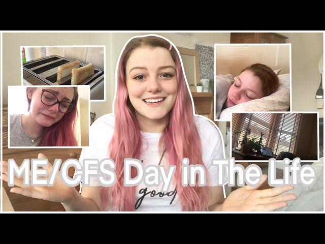 ME/CFS DAY IN THE LIFE Living with Myalgic encephalomyelitis Anxiety Attacks, Medication and Resting