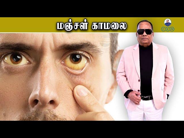 மஞ்சள் காமலை / Dr.C.K.Nandagopalan