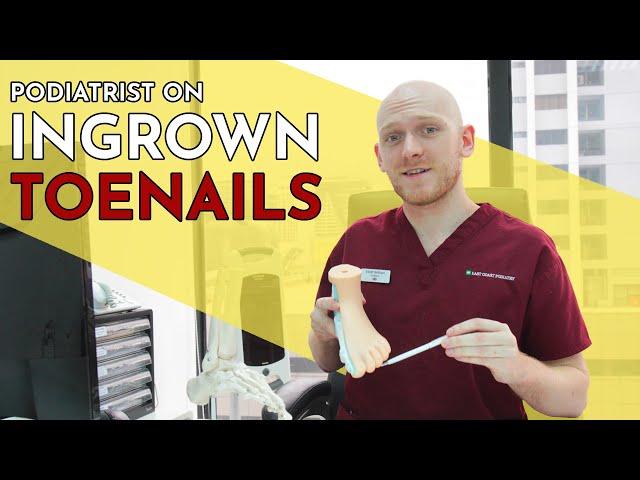 Ingrown Toenails Explained - Senior Podiatrist Elliott Yeldham, East Coast Podiatry