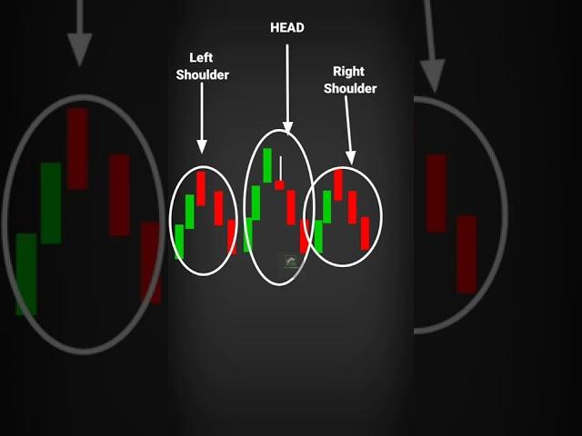 The HEAD & SHOULDER Trend Reversal Pattern #shorts