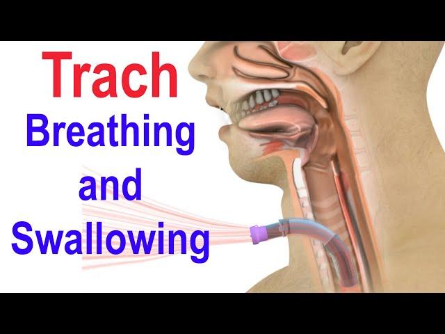 Trach Breathing and Swallowing