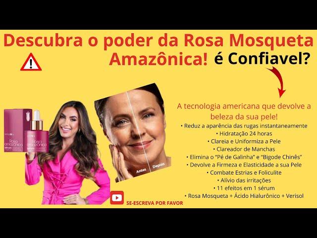 IDRATE A SUA PELE, COM ROSA AMAZÔNICA, PARA AJUDA A TIRAR AS MACHAS DA SUA PELE.