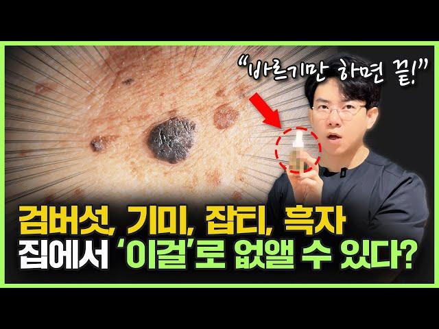 집에서 한번에 쏙! 제거하는 방법?ㅣ검버섯, 기미, 잡티, 흑자, 점 고민이라면 이 영상 꼭 끝가지 보세요!