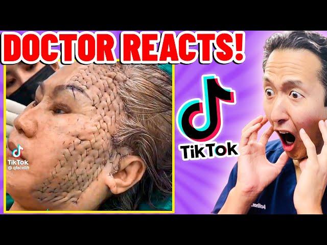 Plastic Surgeon Reacts to OUTRAGEOUS TikTok Videos!