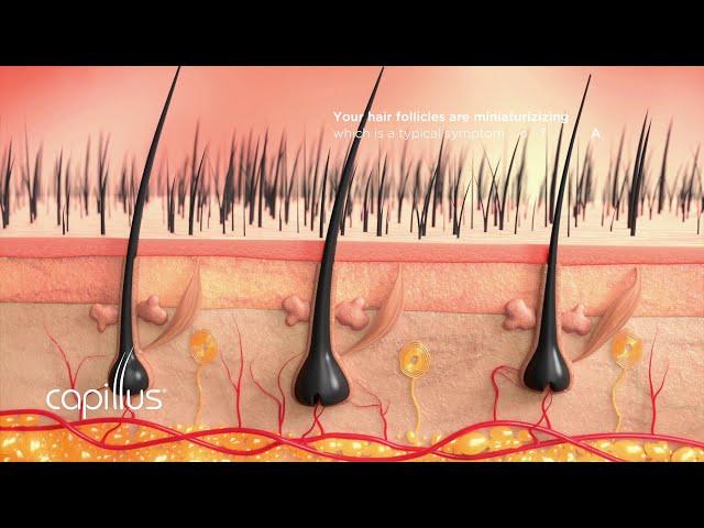 How  Hair Loss Occurs and How to Help Stop It