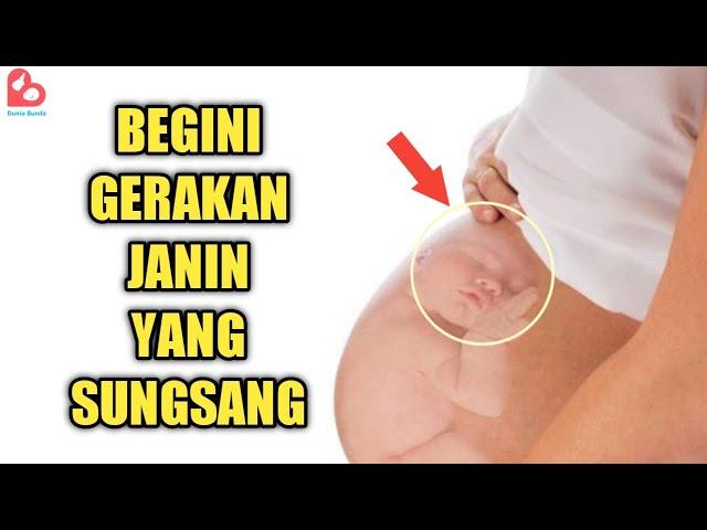 Gerakan Janin Sungsang yang Bisa Dirasakan Ibu Hamil